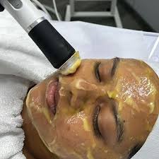 Oxygeneo
