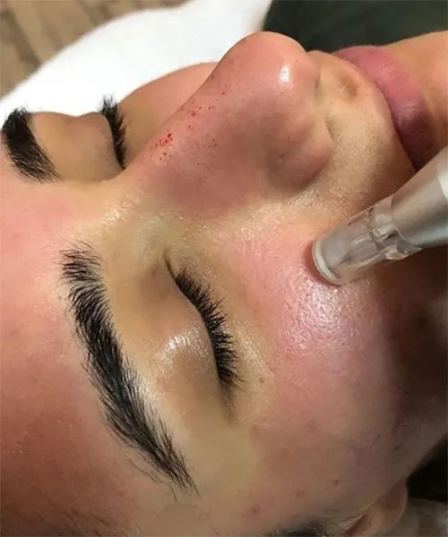 Soins esthétiques